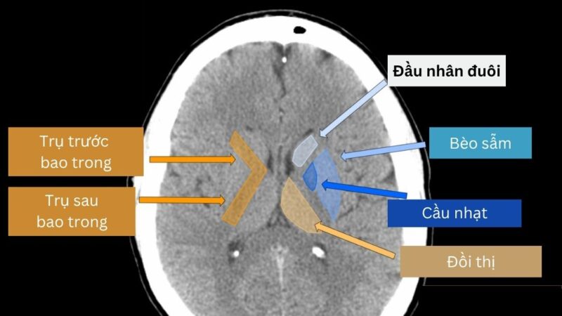 Giải phẫu CT sọ não – Cửa sổ nhu mô
